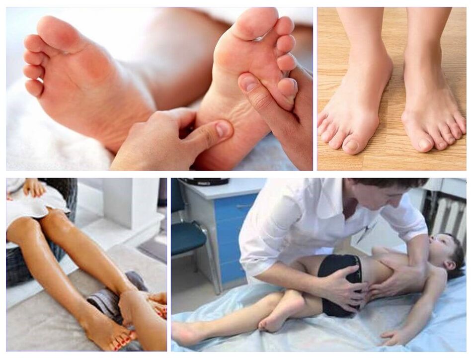 Valgus deformation in children's treatment