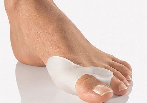 Silicone Lock for the Leg Thumb